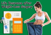 Life Insurance after Weight-Loss Surgery Life Insurance after Weight-Loss Surgery