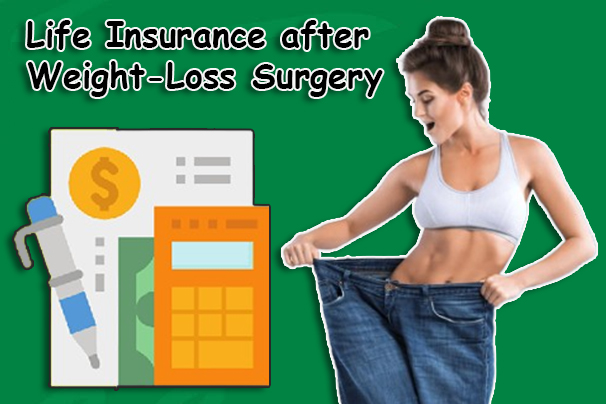 Life Insurance after Weight-Loss Surgery